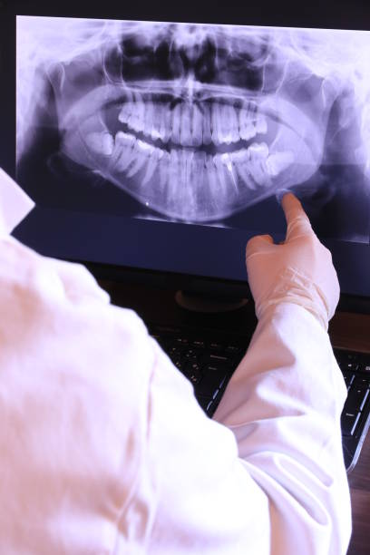 Best Emergency Root Canal Treatment in Monona, IA